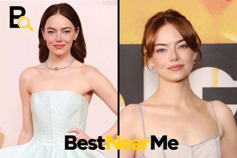 Emma Stone Plastic Surgery