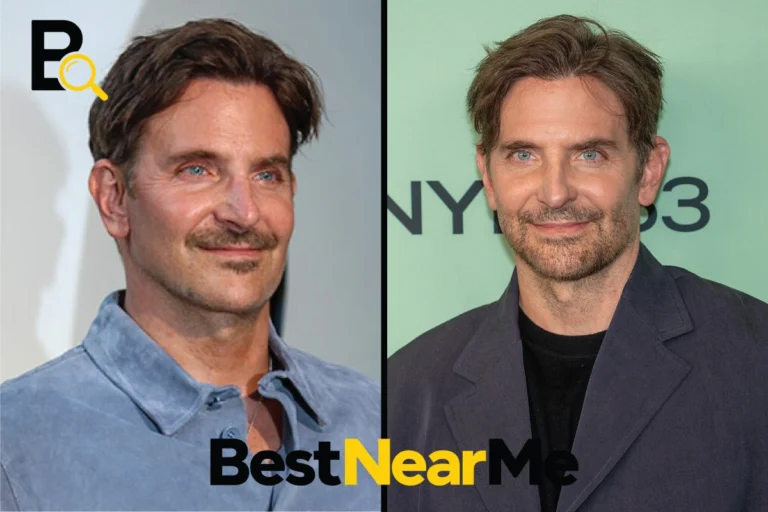 Bradley Cooper Plastic Surgery